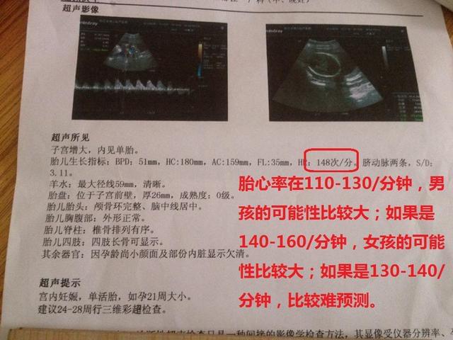 关于三个月能否查出胎儿性别的问题探讨