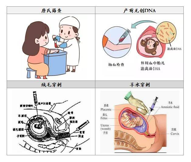 广东省妇幼保健院羊水穿刺流程详解